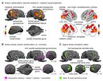 Action observation reveals a network with divergent temporal and parietal lobe engagement in dogs compared to humans